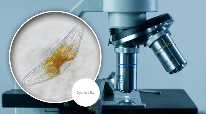 Microscopic alga Cymbella