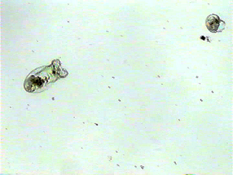 Video filmed under a microscope of Asplanchna
