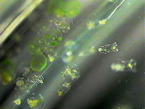 Video filmed under a microscope of rotifers.