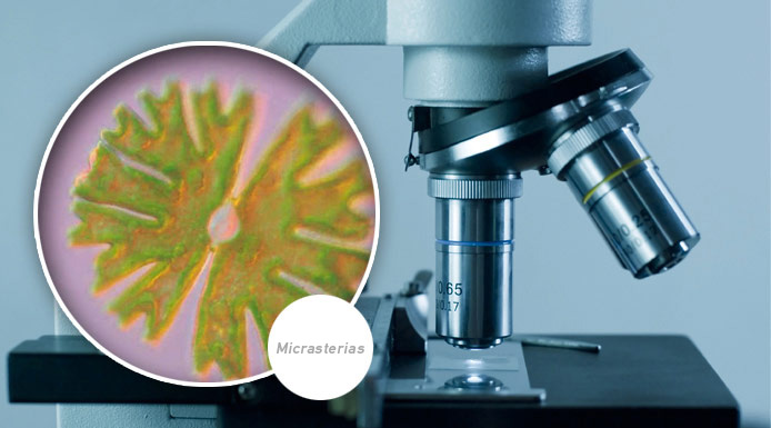 Microscopic photo of the alga Micrasterias